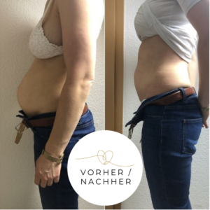Mutter mit festem Bauch nach Rektusdiastase-Therapie